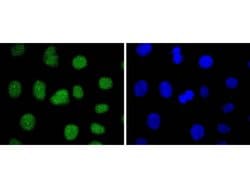 Invitrogen SUZ12 Recombinant Rabbit Monoclonal Antibody (JJ09-04) 100 &mu;L;