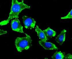 Invitrogen mGluR2 Recombinant Rabbit Monoclonal Antibody (JJ091-09) 100