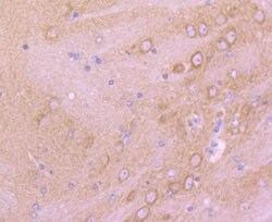 Invitrogen mGluR2 Recombinant Rabbit Monoclonal Antibody (JJ091-09) 100