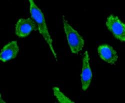 Invitrogen CXCL12 Recombinant Rabbit Monoclonal Antibody (JJ09-20) 100