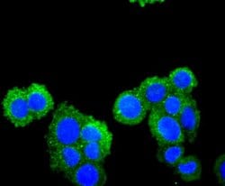 Invitrogen CXCL12 Recombinant Rabbit Monoclonal Antibody (JJ09-20) 100