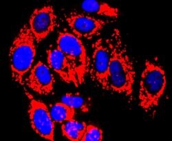 Invitrogen MMP13 Recombinant Rabbit Monoclonal Antibody (JF0893) 100 &mu;L;
