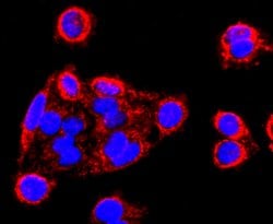 Invitrogen MMP13 Recombinant Rabbit Monoclonal Antibody (JF0893) 100 &mu;L;