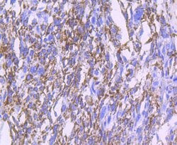 Invitrogen MMP13 Recombinant Rabbit Monoclonal Antibody (JF0893) 100 &mu;L;