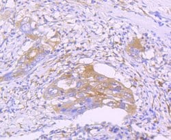 Invitrogen STAT2 Recombinant Rabbit Monoclonal Antibody (JF0884) 100 &mu;L;