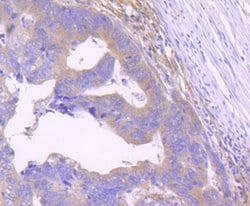 Invitrogen STAT2 Recombinant Rabbit Monoclonal Antibody (JF0884) 100 &mu;L;