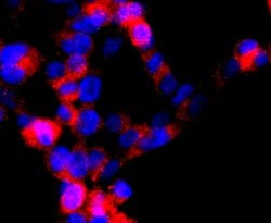 Invitrogen DRD1 Recombinant Rabbit Monoclonal Antibody (JM10-93) 100 &mu;L;