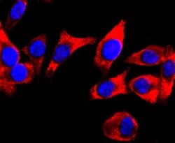 Invitrogen DRD1 Recombinant Rabbit Monoclonal Antibody (JM10-93) 100 &mu;L;