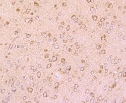 Invitrogen DRD1 Recombinant Rabbit Monoclonal Antibody (JM10-93) 100 &mu;L;