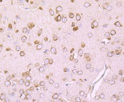 Invitrogen DRD1 Recombinant Rabbit Monoclonal Antibody (JM10-93) 100 &mu;L;