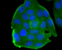 Invitrogen MYH11 Recombinant Rabbit Monoclonal Antibody (JA03-35) 100 &mu;L;