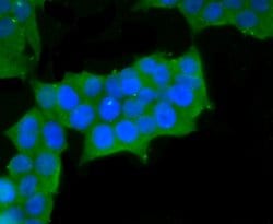 Invitrogen MYH11 Recombinant Rabbit Monoclonal Antibody (JA03-35) 100 &mu;L;
