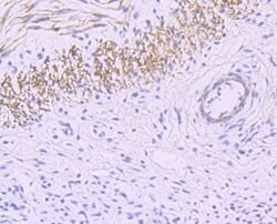 Invitrogen MYH11 Recombinant Rabbit Monoclonal Antibody (JA03-35) 100 &mu;L;
