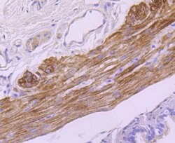 Invitrogen MYH11 Recombinant Rabbit Monoclonal Antibody (JA03-35) 100 &mu;L;