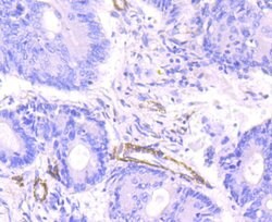 Invitrogen MYH11 Recombinant Rabbit Monoclonal Antibody (JA03-35) 100 &mu;L;