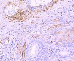 Invitrogen MYH11 Recombinant Rabbit Monoclonal Antibody (JA03-35) 100 &mu;L;
