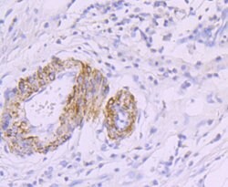 Invitrogen MYH11 Recombinant Rabbit Monoclonal Antibody (JA03-35) 100 &mu;L;