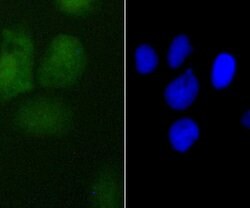 Invitrogen PDCD4 Recombinant Rabbit Monoclonal Antibody (JA80-83) 100 &mu;L;