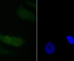 Invitrogen PDCD4 Recombinant Rabbit Monoclonal Antibody (JA80-83) 100 &mu;L;