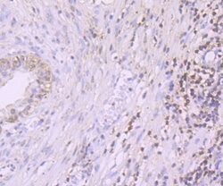Invitrogen PDCD4 Recombinant Rabbit Monoclonal Antibody (JA80-83) 100 &mu;L;
