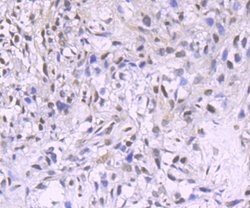 Invitrogen PDCD4 Recombinant Rabbit Monoclonal Antibody (JA80-83) 100 &mu;L;