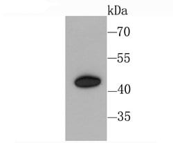 Invitrogen CXCR3 Recombinant Rabbit Monoclonal Antibody (JA61-33) 100 &mu;L;