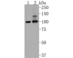 Invitrogen PSD93 Recombinant Rabbit Monoclonal Antibody (JM41-04) 100 &mu;L;