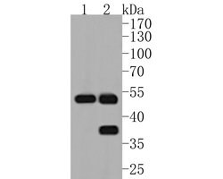 Invitrogen MMP3 Recombinant Rabbit Monoclonal Antibody (JM46-22) 100 &mu;L | Buy Online | Invitrogen&trade; | Fisher Scientific