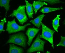 Invitrogen WNT2B Recombinant Rabbit Monoclonal Antibody (JB48-34) 100 &mu;L | Buy Online | Invitrogen&trade; | Fisher Scientific