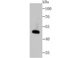 Invitrogen WNT2B Recombinant Rabbit Monoclonal Antibody (JB48-34) 100 &mu;L | Buy Online | Invitrogen&trade; | Fisher Scientific