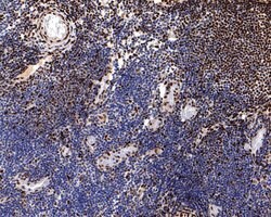 Invitrogen Phospho-CREB (Ser133) Recombinant Rabbit Monoclonal Antibody