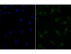 Invitrogen Nucleostemin Recombinant Rabbit Monoclonal Antibody (JG37-82)
