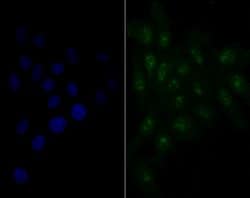 Invitrogen Nucleostemin Recombinant Rabbit Monoclonal Antibody (JG37-82)
