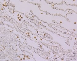 Invitrogen Nucleostemin Recombinant Rabbit Monoclonal Antibody (JG37-82)