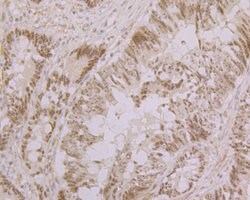 Invitrogen Nucleostemin Recombinant Rabbit Monoclonal Antibody (JG37-82)