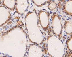 Invitrogen ICAD Recombinant Rabbit Monoclonal Antibody (JE49-23) 100 &mu;L;