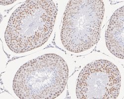 Invitrogen GTF2F2 Recombinant Rabbit Monoclonal Antibody (JE56-15) 100