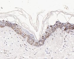 Invitrogen GTF2F2 Recombinant Rabbit Monoclonal Antibody (JE56-15) 100