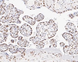 Invitrogen GTF2F2 Recombinant Rabbit Monoclonal Antibody (JE56-15) 100
