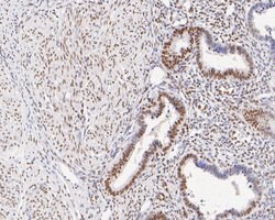 Invitrogen GTF2F2 Recombinant Rabbit Monoclonal Antibody (JE56-15) 100