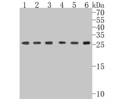 Invitrogen GTF2F2 Recombinant Rabbit Monoclonal Antibody (JE56-15) 100