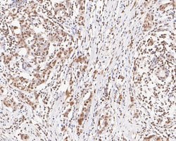 Invitrogen UBE2B Recombinant Rabbit Monoclonal Antibody (JE56-12) 100 &mu;L;
