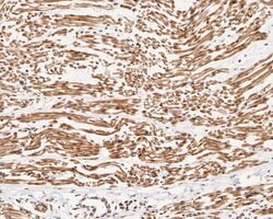 Invitrogen UBE2B Recombinant Rabbit Monoclonal Antibody (JE56-12) 100 &mu;L;