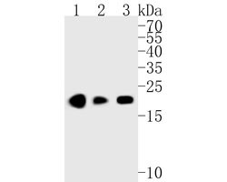 Invitrogen UBE2B Recombinant Rabbit Monoclonal Antibody (JE56-12) 100 &mu;L;