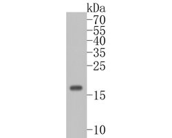 Invitrogen UBE2B Recombinant Rabbit Monoclonal Antibody (JE56-12) 100 &mu;L;