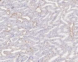 Invitrogen GTF2I Recombinant Rabbit Monoclonal Antibody (JE56-20) 100 &mu;L;