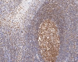 Invitrogen GTF2I Recombinant Rabbit Monoclonal Antibody (JE56-20) 100 &mu;L;
