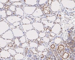 Invitrogen GTF2I Recombinant Rabbit Monoclonal Antibody (JE56-20) 100 &mu;L;