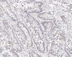 Invitrogen GTF2I Recombinant Rabbit Monoclonal Antibody (JE56-20) 100 &mu;L;
