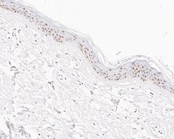 Invitrogen GTF2I Recombinant Rabbit Monoclonal Antibody (JE56-20) 100 &mu;L;